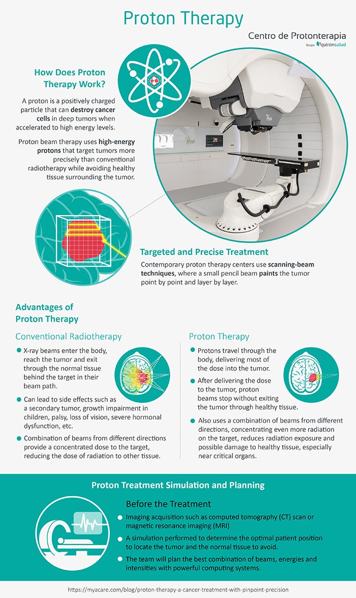 Proton Therapy:How it works,Targeted & Precise treatment,advantages over conventional radiotherapy,Proton Simulation/planning