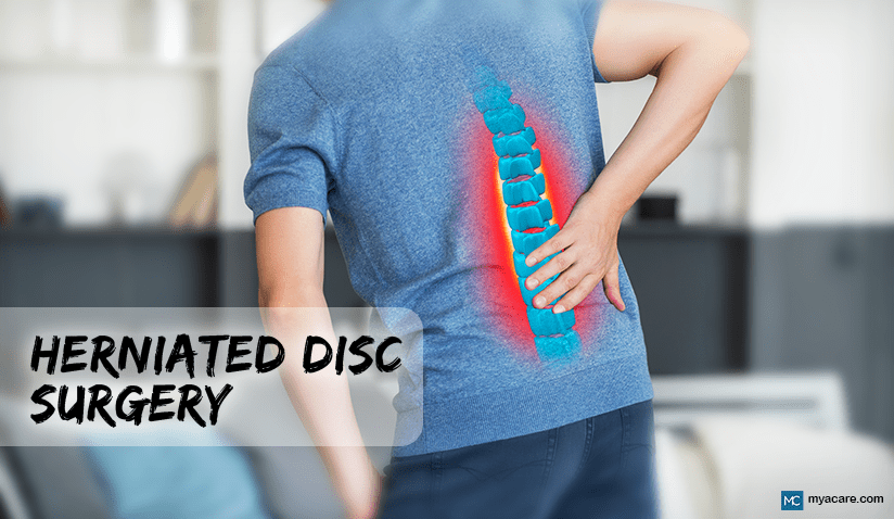 SHOULD I HAVE SURGERY FOR A HERNIATED DISC?