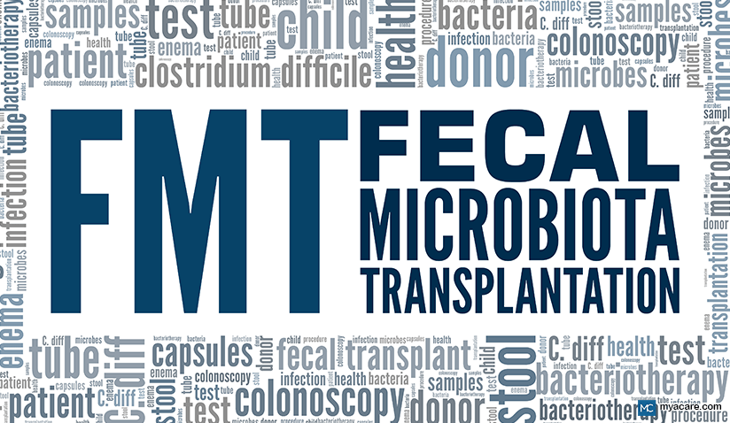 REVITALIZING GUT HEALTH: FECAL TRANSPLANT FOR C. DIFF AND BEYOND