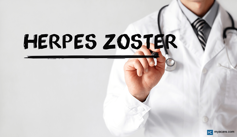 ITCHY AND PAINFUL: HERPES ZOSTER (SHINGLES)