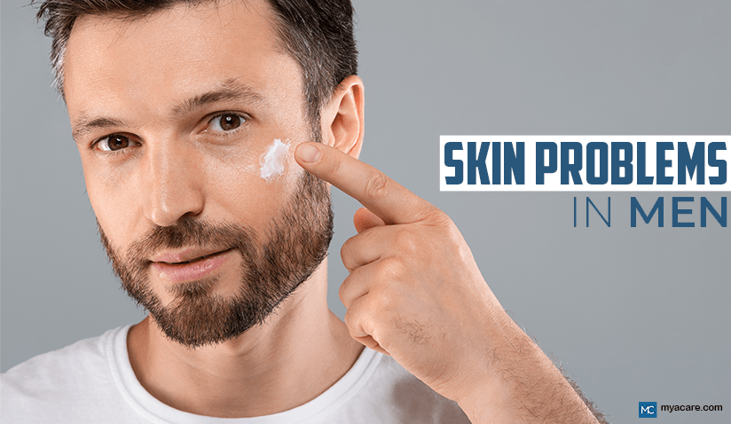 SKIN PROBLEMS IN MEN