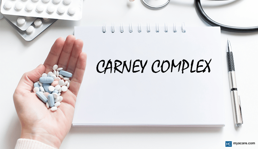 UNDERSTANDING CARNEY COMPLEX: SYMPTOMS AND TREATMENT