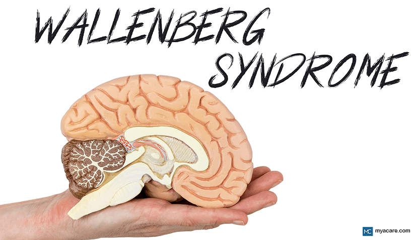 WALLENBERG SYNDROME – SYMPTOMS, CAUSES, RISK FACTORS AND TREATMENT