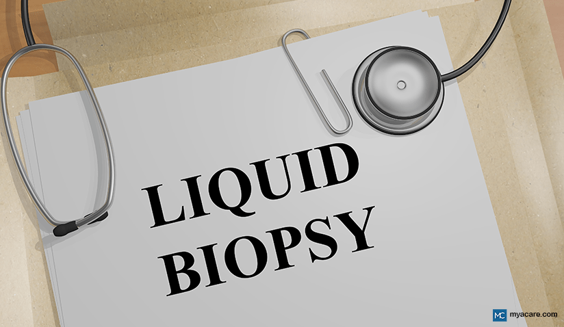 WHAT IS LIQUID BIOPSY? MARKERS, TECHNIQUES, AND LATEST ADVANCEMENTS 