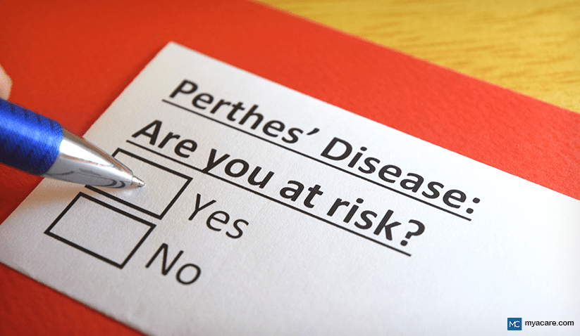 ALL YOU NEED TO KNOW ABOUT LEGG–CALVÉ–PERTHES DISEASE: SYMPTOMS, CAUSES, AND TREATMENT
