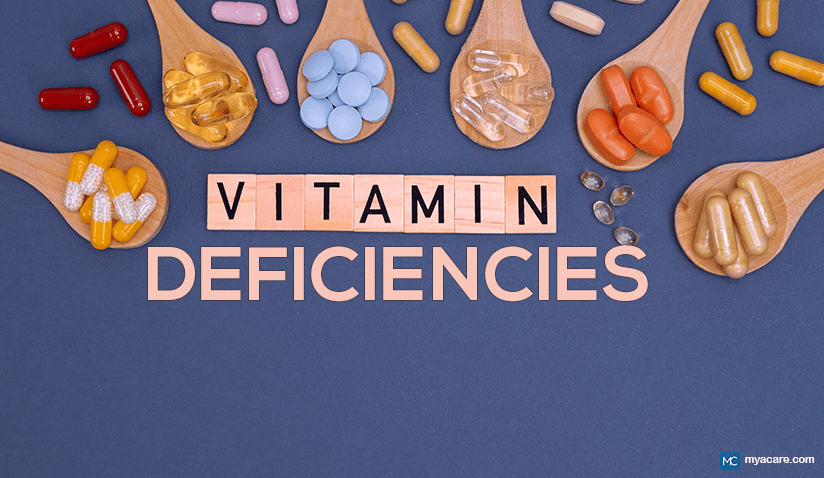 VITAMIN DEFICIENCIES: SIGNS, IMPACT, AND HOW TO PREVENT