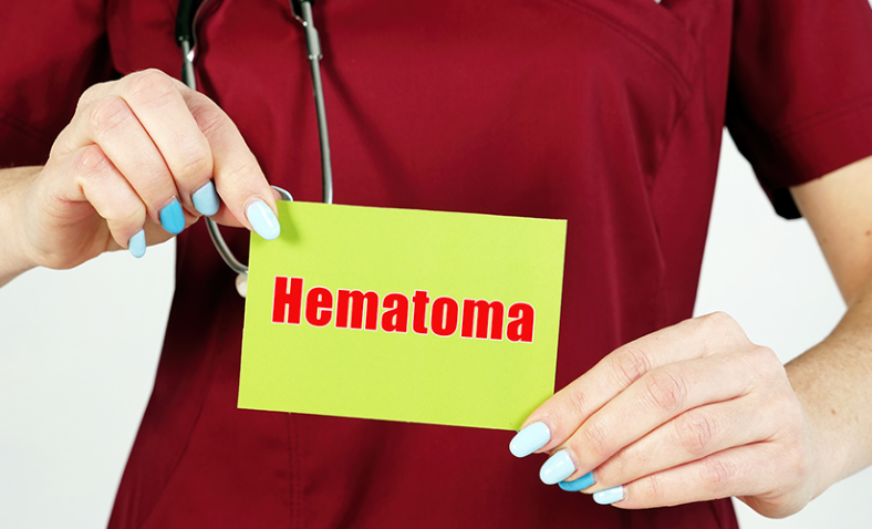 WHEN DOES A HEMATOMA NEED TO BE DRAINED?