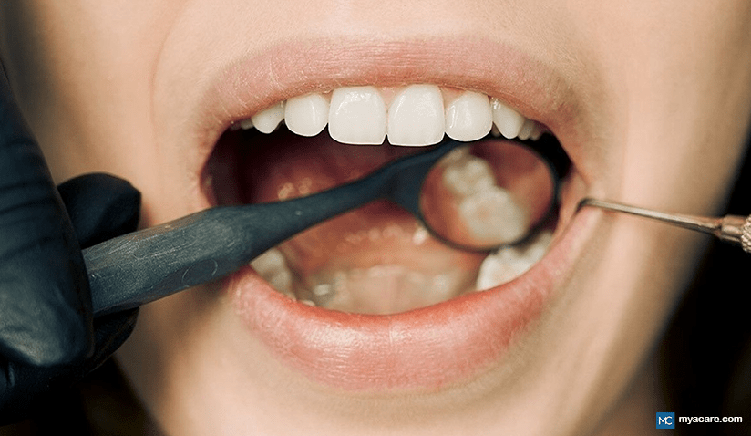 THE EFFECTS OF STEROIDS ON ORAL HEALTH: APPLICATIONS AND SIDE EFFECTS
