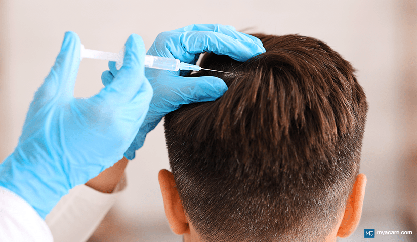 DOES PLATELET-RICH PLASMA (PRP) THERAPY WORK? | Mya Care