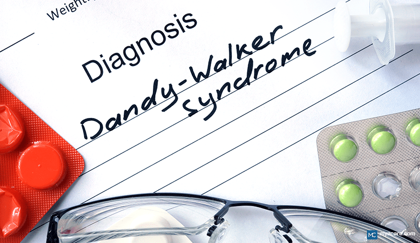 UNDERSTANDING DANDY-WALKER SYNDROME: THE RARE CONGENITAL BRAIN MALFORMATION