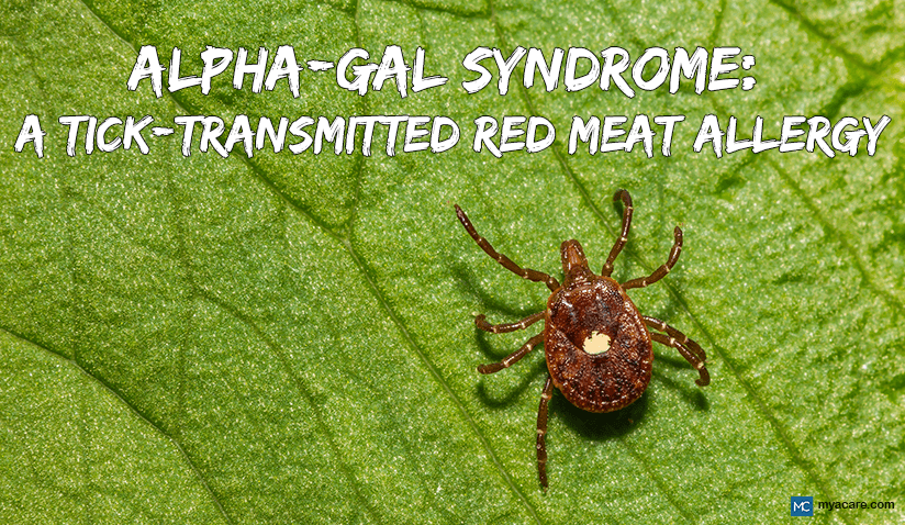 ALPHA-GAL SYNDROME: A TICK-TRANSMITTED RED MEAT ALLERGY EVERYONE SHOULD KNOW ABOUT