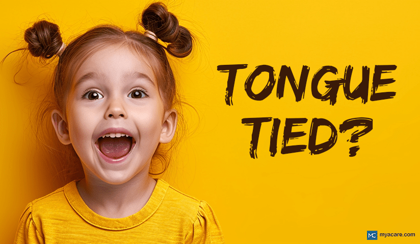 TONGUE TIED? UNDERSTANDING TONGUE TIE SURGERY FOR CHILDREN AND ADULTS