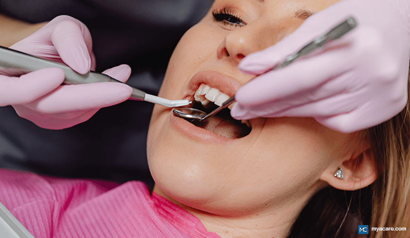 WHAT IS TOOTH FILLING AND WHAT ARE THE DIFFERENT DENTAL FILLING OPTIONS?