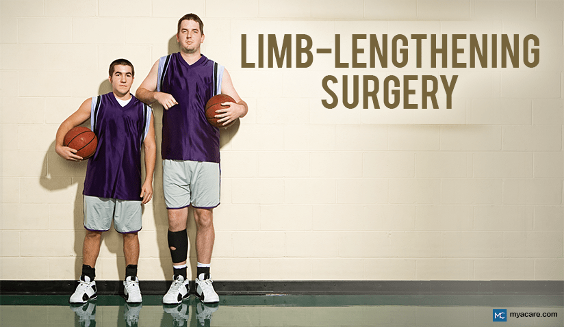 LIMB-LENGTHENING SURGERY: PROS AND CONS