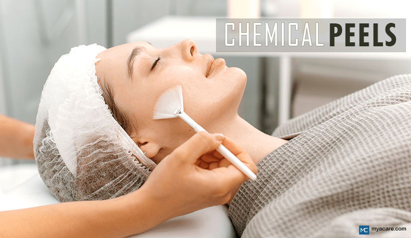 THE ART OF CHEMICAL PEELS