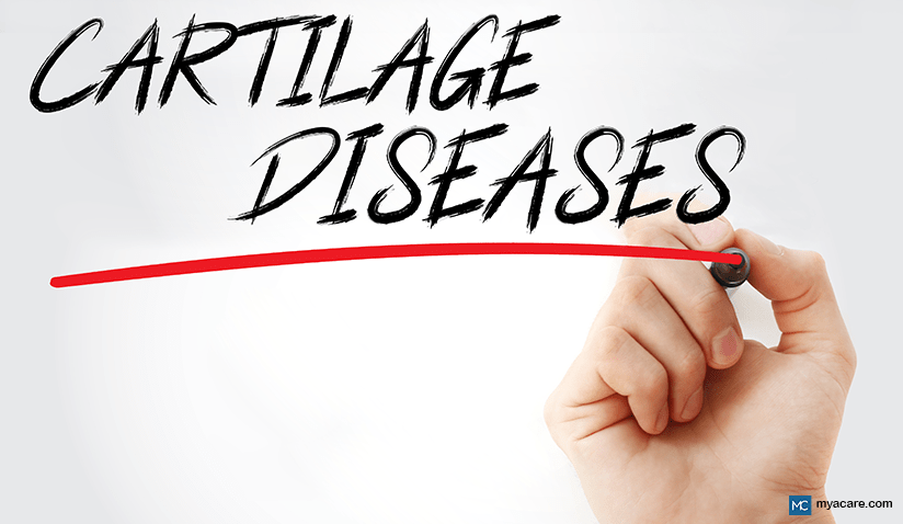 CARTILAGE DISEASES: TOP REASONS WHY CARTILAGE WEAKENS