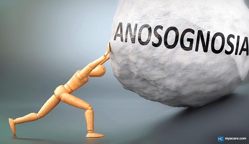 ANOSOGNOSIA - WHEN YOUR BRAIN DENIES REALITY