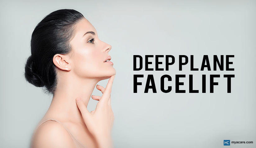 EVERYTHING YOU NEED TO KNOW ABOUT DEEP PLANE FACELIFT