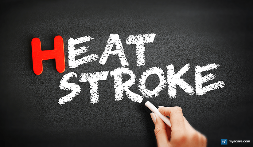 BEATING THE HEAT: UNDERSTANDING, PREVENTING, AND TREATING HEAT STROKE