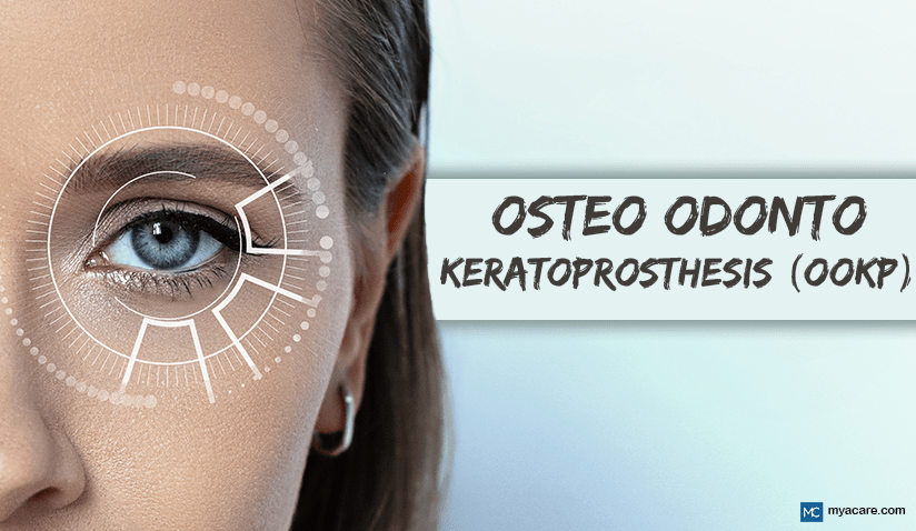 TOOTH-IN-EYE SURGERY: ALL YOU NEED TO KNOW ABOUT OOKP