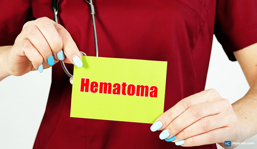 WHEN DOES A HEMATOMA NEED TO BE DRAINED?
