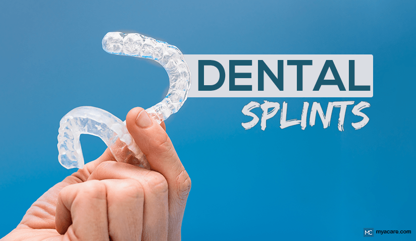 DENTAL SPLINTS- TYPES, BENEFITS, AND MAINTAINANCE