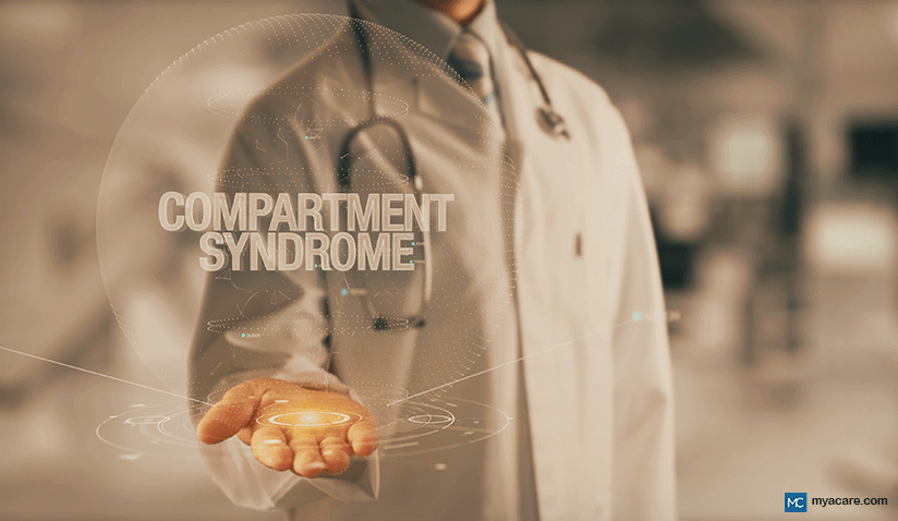 Compartment Syndrome - OrthoInfo - AAOS