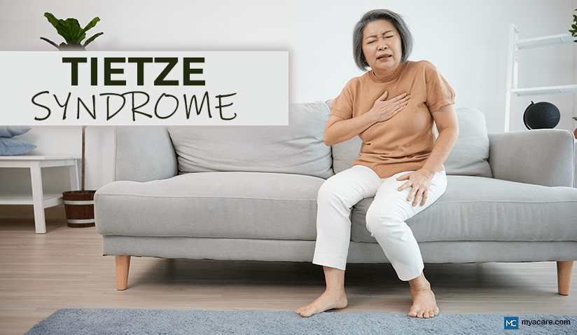 TIETZE SYNDROME: CAUSES, SYMPTOMS, AND TREATMENT 