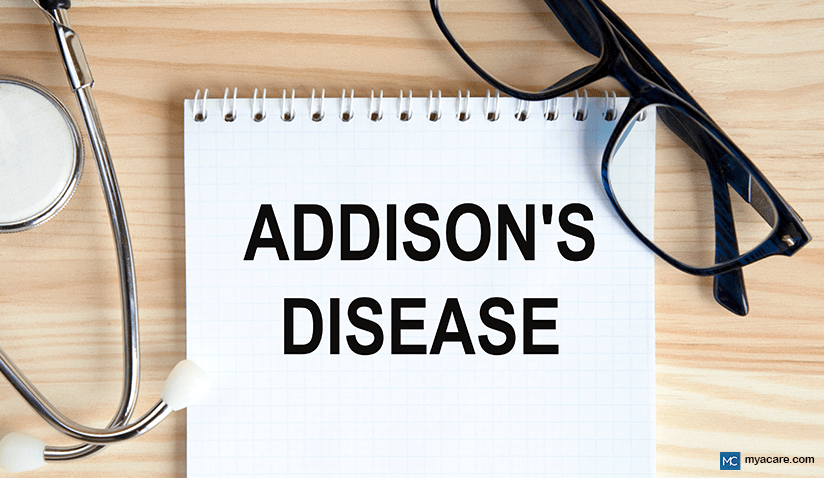 WHAT IS ADDISON’S DISEASE? DIAGNOSIS AND TREATMENT