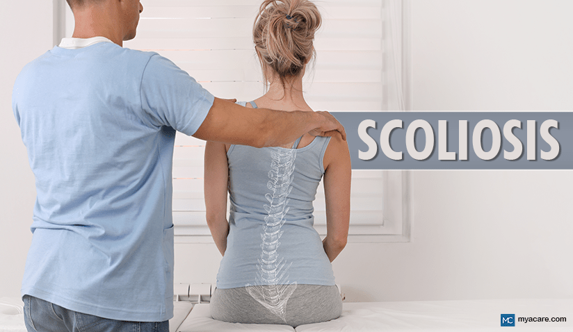 ADULT SCOLIOSIS: TYPES, LATEST ADVANCEMENTS, LIVING WITH, AND MORE