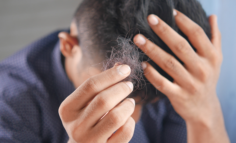 WORRIED ABOUT HAIR LOSS AND THE SIDE EFFECTS OF PRODUCTS LIKE ROGAINE? LEARN MORE HERE.