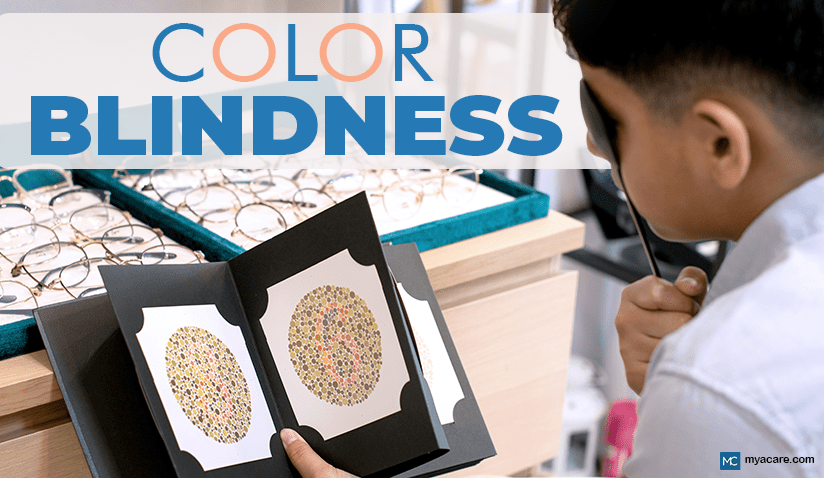 COLOR BLINDNESS: CAUSES, TYPES, SYMPTOMS, TREATMENT AND MORE