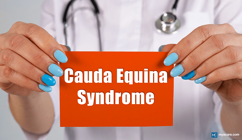 WHAT IS CAUDA EQUINA SYNDROME?