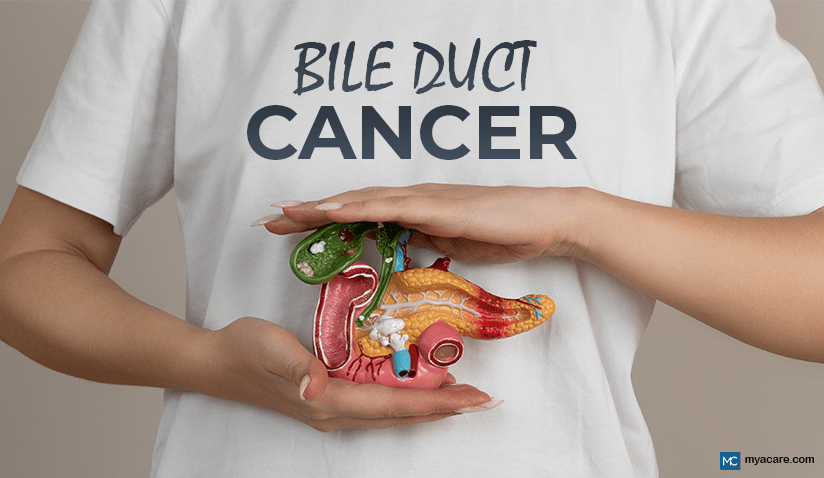 BILE DUCT CANCER: A RARE AND CHALLENGING CONDITION