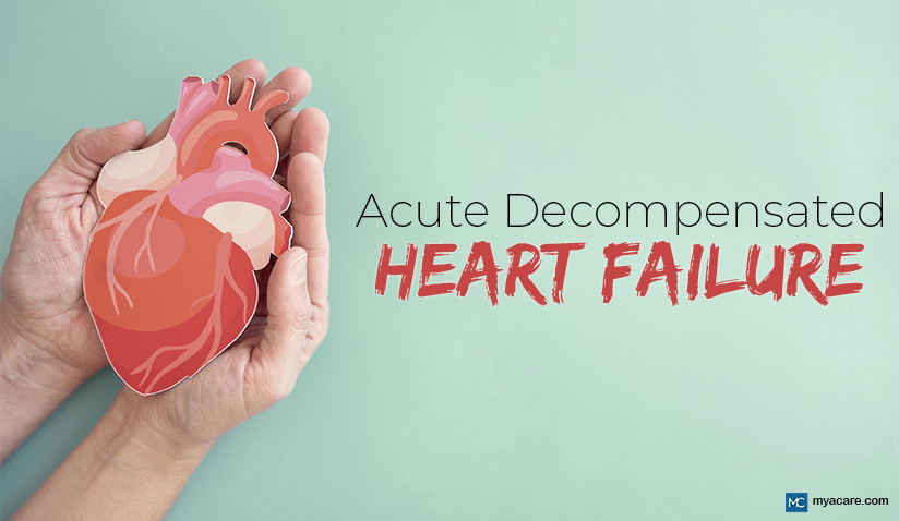 UNDERSTANDING ACUTE DECOMPENSATED HEART FAILURE: RISK, DIAGNOSIS AND TREATMENT