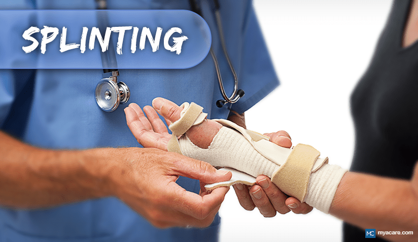 SPLINTING: TYPES, USES, BENEFITS, AND MORE
