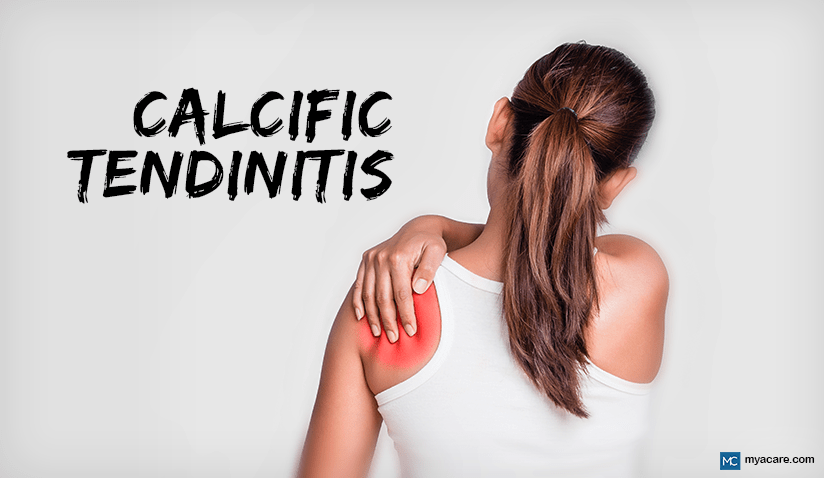 CALCIFIC TENDINITIS: TYPES, SYMPTOMS, DIAGNOSIS, AND TREATMENT