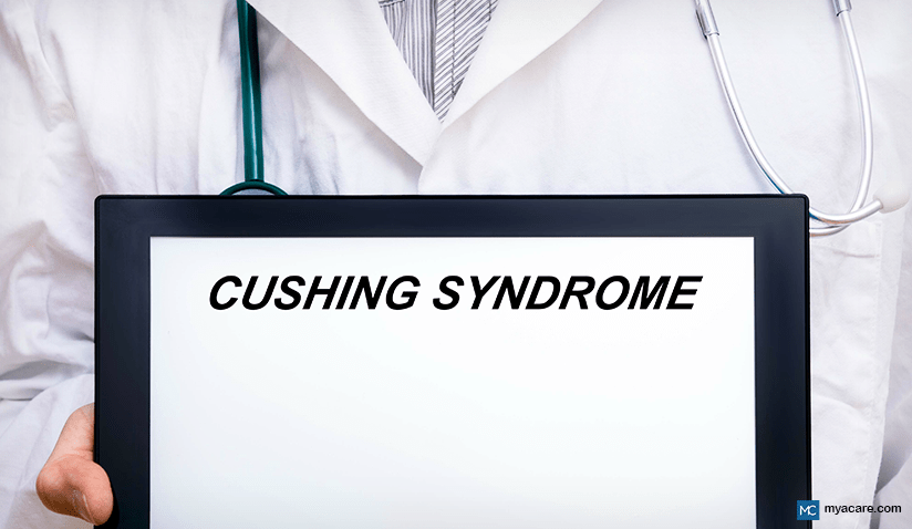 CUSHING SYNDROME: CAUSES, SYMPTOMS, AND TREATMENT