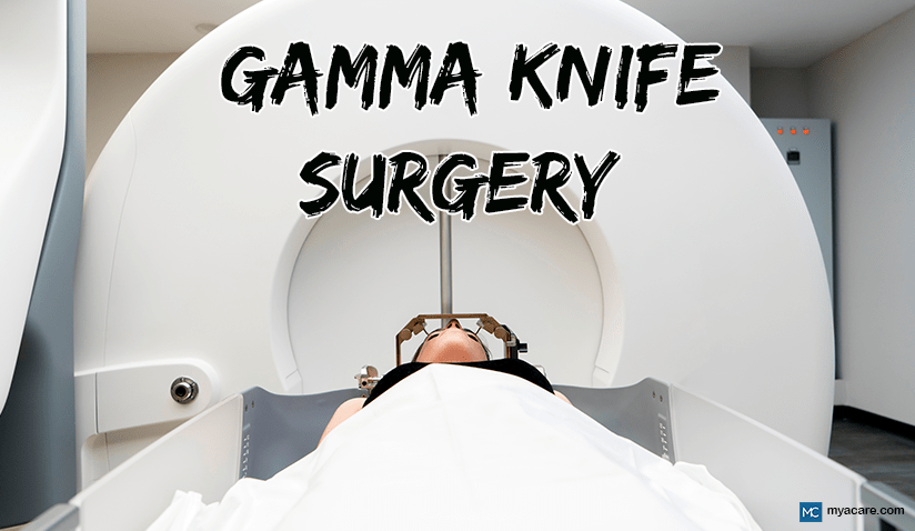 GAMMA KNIFE SURGERY: WHAT CAN IT TREAT BESIDES BRAIN TUMORS?