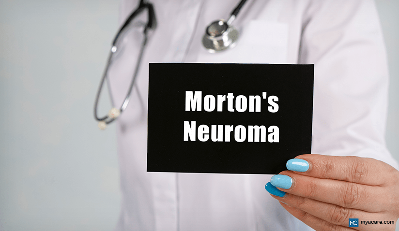 MORTON’S NEUROMA: SYMPTOMS, CAUSES, TREATMENT