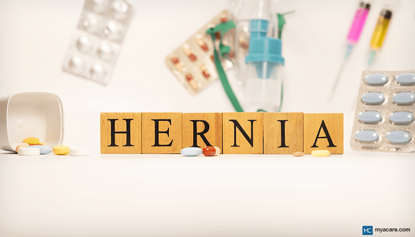 HERNIA: COMMON AND RARE TYPES, CAUSES, SYMPTOMS, NEW REPAIR TECHNIQUES