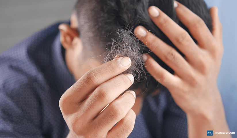 WORRIED ABOUT HAIR LOSS AND THE SIDE EFFECTS OF PRODUCTS LIKE ROGAINE?  LEARN MORE HERE. | Mya Care