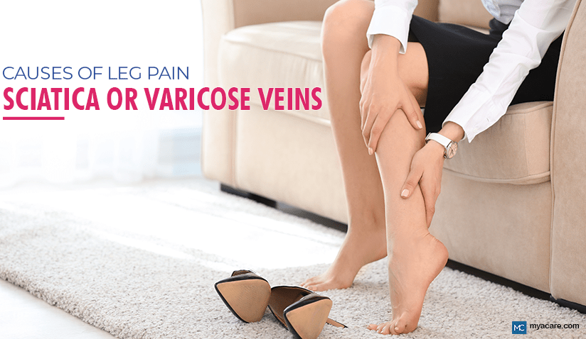 IS MY LEG PAIN CAUSED BY SCIATICA OR VARICOSE VEINS?