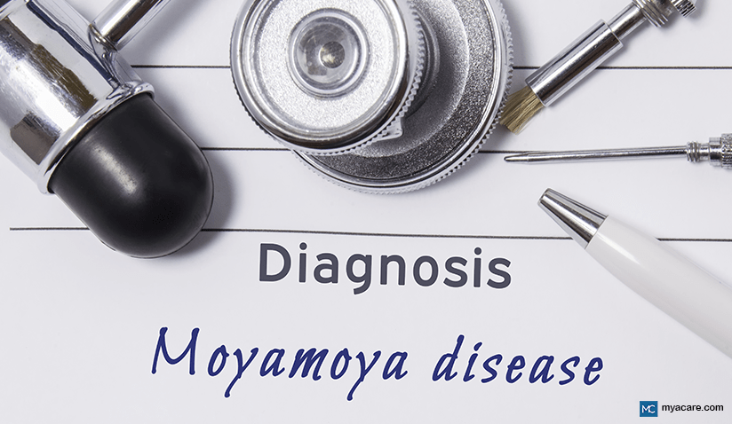 MOYAMOYA DISEASE: CAUSES, SYMPTOMS, DIAGNOSIS, TREATMENT AND MORE 