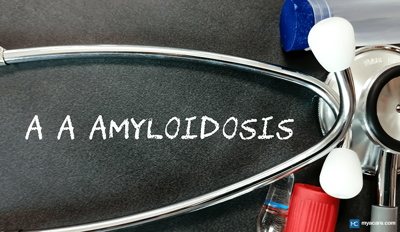 SECONDARY (AA) AMYLOIDOSIS: SYMPTOMS, CAUSES, COMPLICATIONS, AND TREATMENT
