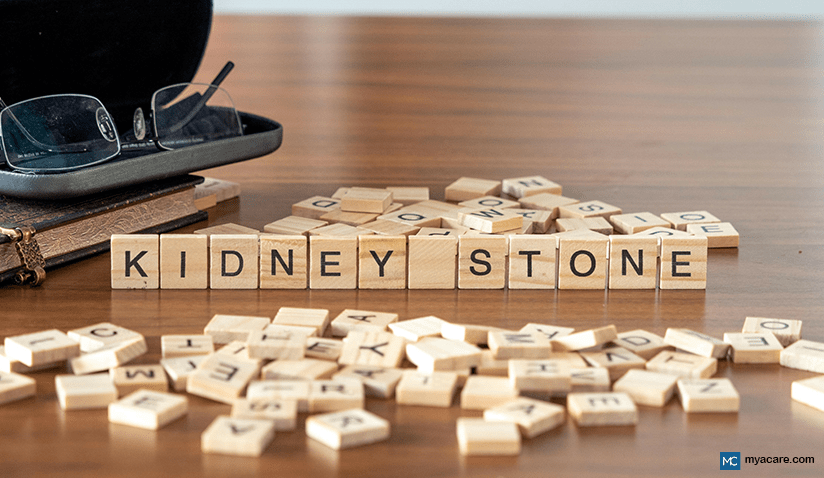 SAFELY PASSING KIDNEY STONES AT HOME: NATURAL REMEDIES