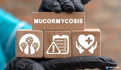 BLACK FUNGUS (RHINOCEREBRAL MUCORMYCOSIS): CAUSES, SYMPTOMS, TREATMENT AND MORE