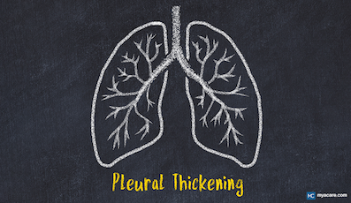 WHAT CAUSES PLEURAL THICKENING? SYMPTOMS, DIAGNOSIS, LATEST IN TREATMENT