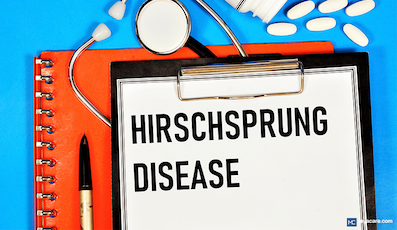 HIRSCHSPRUNG DISEASE OR INFANTILE CONSTIPATION? CAUSES AND TREATMENT