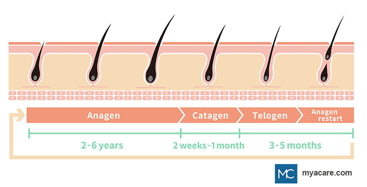 Hair Growth Cycle - Anagen (2 - 6 years), Catagen (2 weeks - 1 month), Telogen (3 - 5 months), Anagen restart